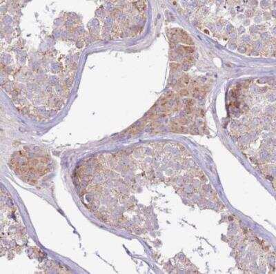 Immunohistochemistry-Paraffin: TRAPPC4 Antibody [NBP2-13476]