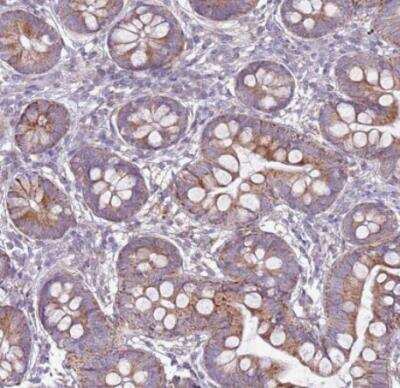 Immunohistochemistry-Paraffin: TRAPPC4 Antibody [NBP2-13476]