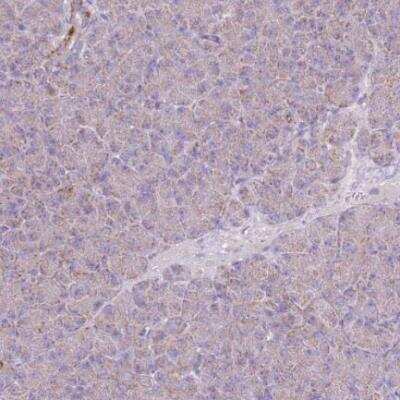 Immunohistochemistry-Paraffin: TRAPPC4 Antibody [NBP2-13476]