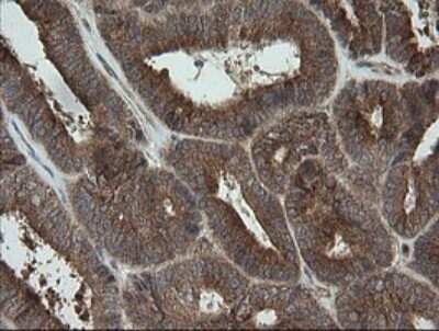 Immunohistochemistry: TRAPPC4 Antibody (OTI2G8) - Azide and BSA Free [NBP2-74594]