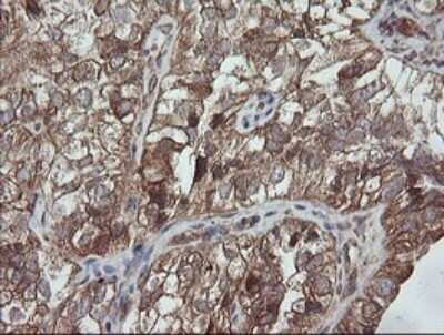 Immunohistochemistry: TRAPPC4 Antibody (OTI2G8) - Azide and BSA Free [NBP2-74594]