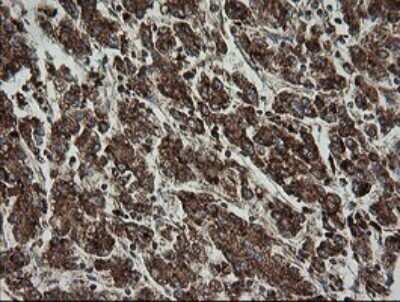Immunohistochemistry: TRAPPC4 Antibody (OTI2G8) - Azide and BSA Free [NBP2-74594]