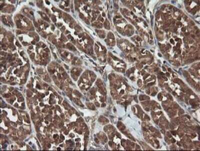 Immunohistochemistry: TRAPPC4 Antibody (OTI2G8) - Azide and BSA Free [NBP2-74594]