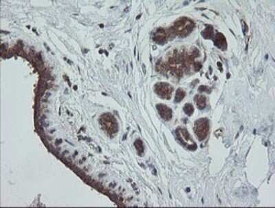 Immunohistochemistry: TRAPPC4 Antibody (OTI2G8) - Azide and BSA Free [NBP2-74594]
