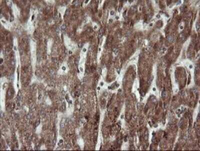 Immunohistochemistry: TRAPPC4 Antibody (OTI2G8) - Azide and BSA Free [NBP2-74594]