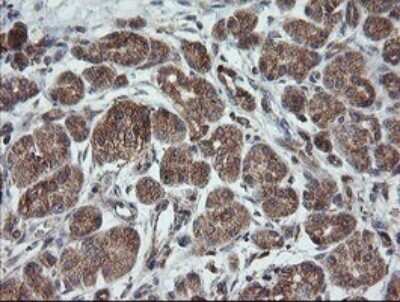 Immunohistochemistry: TRAPPC4 Antibody (OTI2G8) - Azide and BSA Free [NBP2-74594]