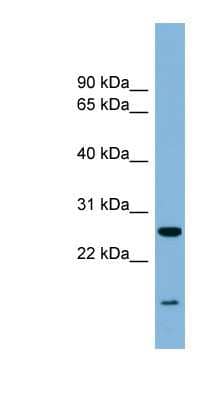 Western Blot: TRAPPC4 Antibody [NBP1-79646]