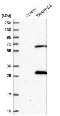 Western Blot: TRAPPC4 Antibody [NBP2-13475]