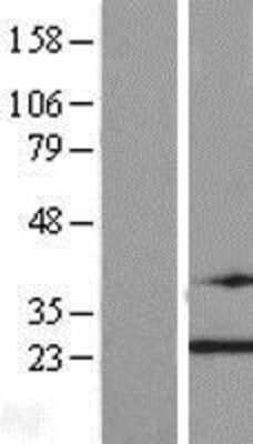 Western Blot: TRAPPC4 Overexpression Lysate [NBL1-17259]