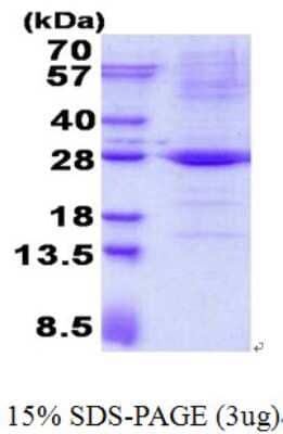 SDS-PAGE: Recombinant Human TRAPPC4 His Protein [NBP2-22876]