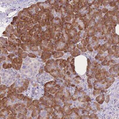 Immunohistochemistry-Paraffin: TRAPPC5 Antibody [NBP2-13477]