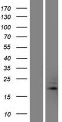 Western Blot: TRAPPC5 Overexpression Lysate [NBP2-05074]