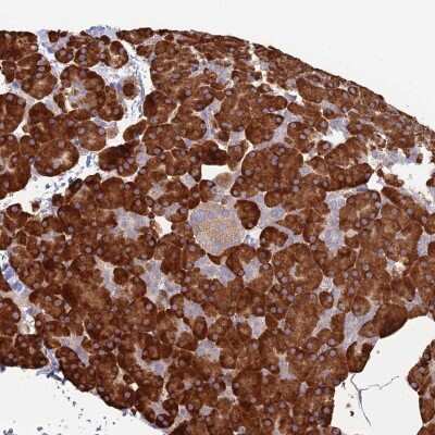 Immunohistochemistry-Paraffin: TRAPPC6A Antibody [NBP1-83167]