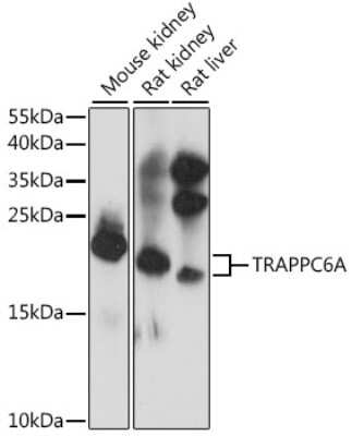 Western Blot: TRAPPC6A AntibodyAzide and BSA Free [NBP2-94046]