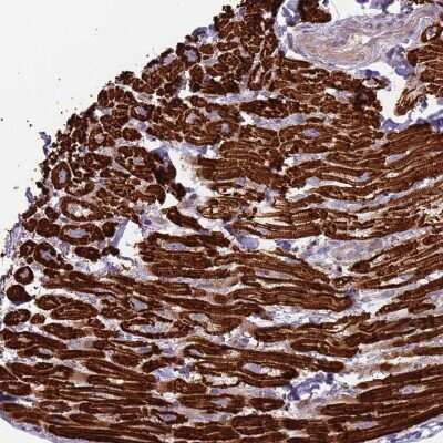 Immunohistochemistry-Paraffin: TRAPPC6B Antibody [NBP2-13478]