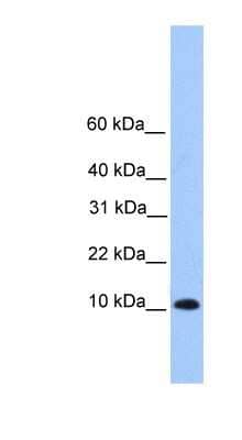 Western Blot: TRAPPC6B Antibody [NBP1-70736]