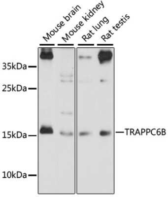 Western Blot: TRAPPC6B AntibodyAzide and BSA Free [NBP2-93297]