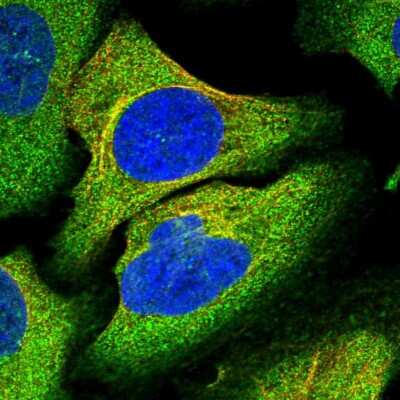 Immunocytochemistry/ Immunofluorescence: TRAPPC8 Antibody [NBP1-93708]