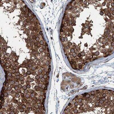 Immunohistochemistry-Paraffin: TRAPPC8 Antibody [NBP1-93708]