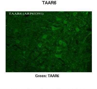 Immunohistochemistry: TRAR4 Antibody [NBP2-86871]