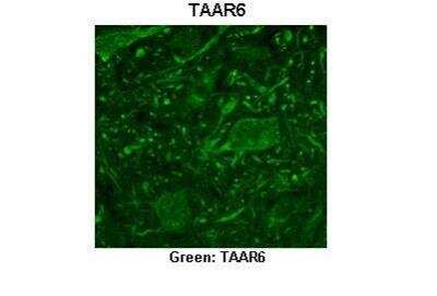 Immunohistochemistry: TRAR4 Antibody [NBP2-86871]