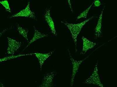 Immunocytochemistry/ Immunofluorescence: TRAX Antibody [NBP2-98951]