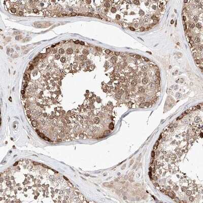 Immunohistochemistry-Paraffin: TRAX Antibody [NBP1-80665]