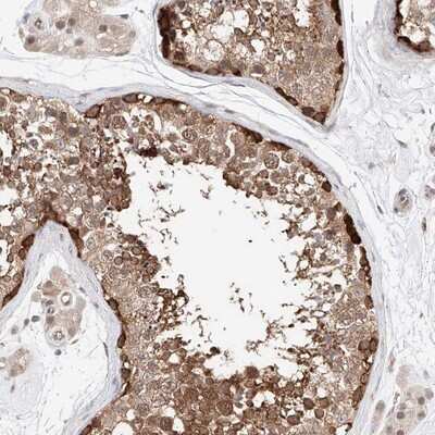 Immunohistochemistry-Paraffin: TRAX Antibody [NBP1-80666]