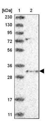 Western Blot: TRAX Antibody [NBP1-80665]