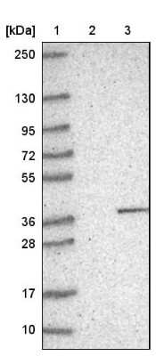 Western Blot: TRAX Antibody [NBP1-80666]