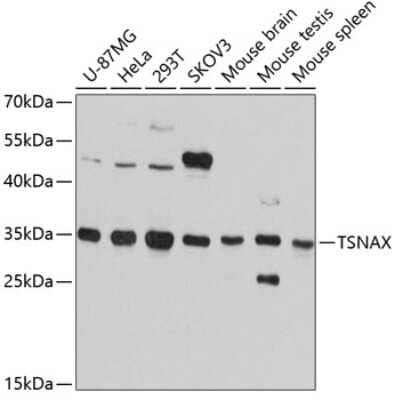 Western Blot: TRAX AntibodyAzide and BSA Free [NBP2-93964]