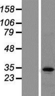 Western Blot: TRAX Overexpression Lysate [NBP2-10435]