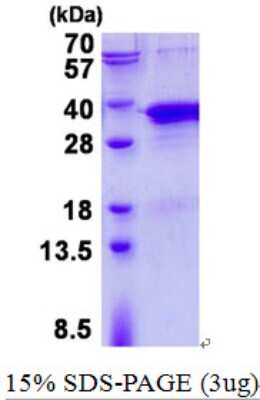 SDS-PAGE: Recombinant Human TRAX His Protein [NBP2-22881]