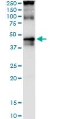 Western Blot: TRBP Antibody (1D9) [H00006895-M03]