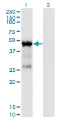 Western Blot: TRBP Antibody (1D9) [H00006895-M03]