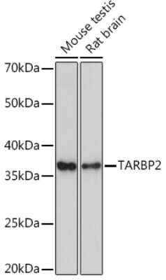 Western Blot: TRBP Antibody (9E6C9) [NBP3-16753]