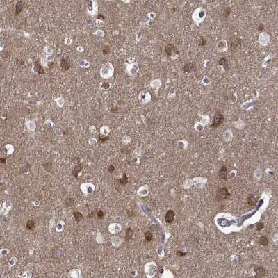 Immunohistochemistry: TRBP Antibody [NBP2-49334]