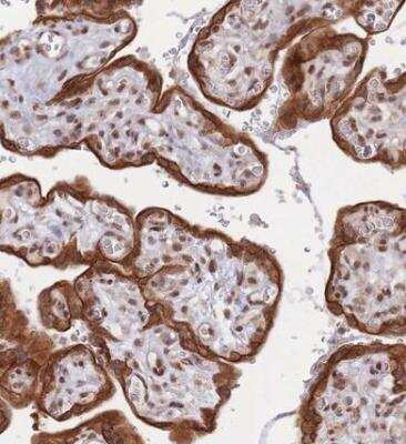 Immunohistochemistry-Paraffin: TRBP Antibody [NBP2-13411]