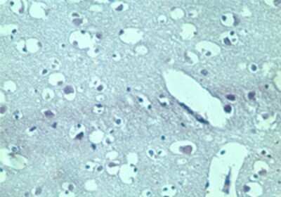 Immunohistochemistry-Paraffin: TRBP Antibody [NBP2-24725]