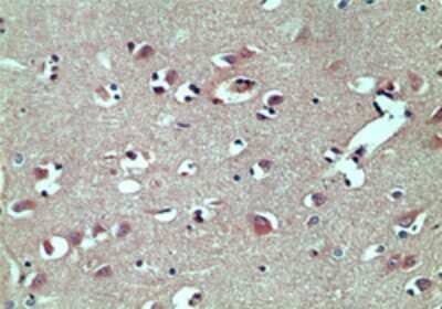 Immunohistochemistry-Paraffin: TRBP Antibody [NBP2-24725]