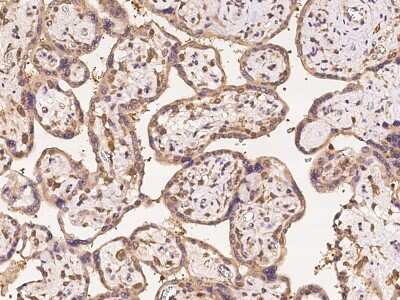 Immunohistochemistry-Paraffin: TRBP Antibody [NBP2-98056]