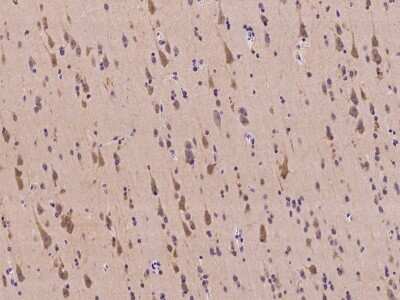 Immunohistochemistry-Paraffin: TRBP Antibody [NBP2-98056]