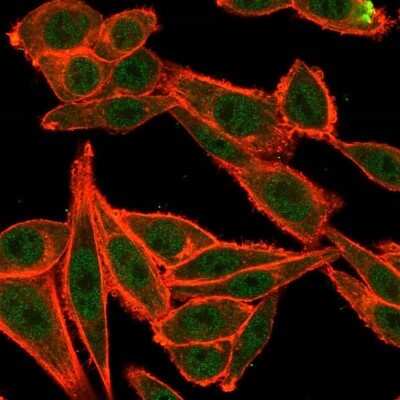 Immunocytochemistry/ Immunofluorescence: TRBP Antibody (PCRP-TARBP2-1E5) [NBP3-07335]