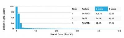 Protein Array: TRBP Antibody (PCRP-TARBP2-1E5) [NBP3-07335]