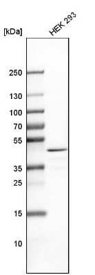 Western Blot: TRBP Antibody [NBP2-13411]