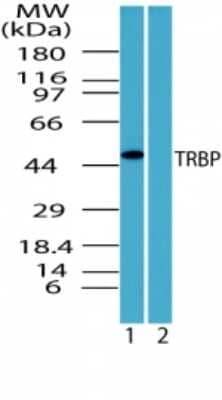 Western Blot: TRBP Antibody [NBP2-24725]