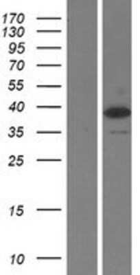 Western Blot: TRBP Overexpression Lysate [NBP2-05689]