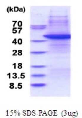 SDS-PAGE: Recombinant Human TRBP Protein [NBP2-51714]