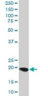 Western Blot: TRDD3 Antibody [H00028523-B01P]