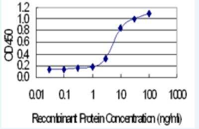 ELISA: TREH Antibody (2D10) [H00011181-M02-100ug]